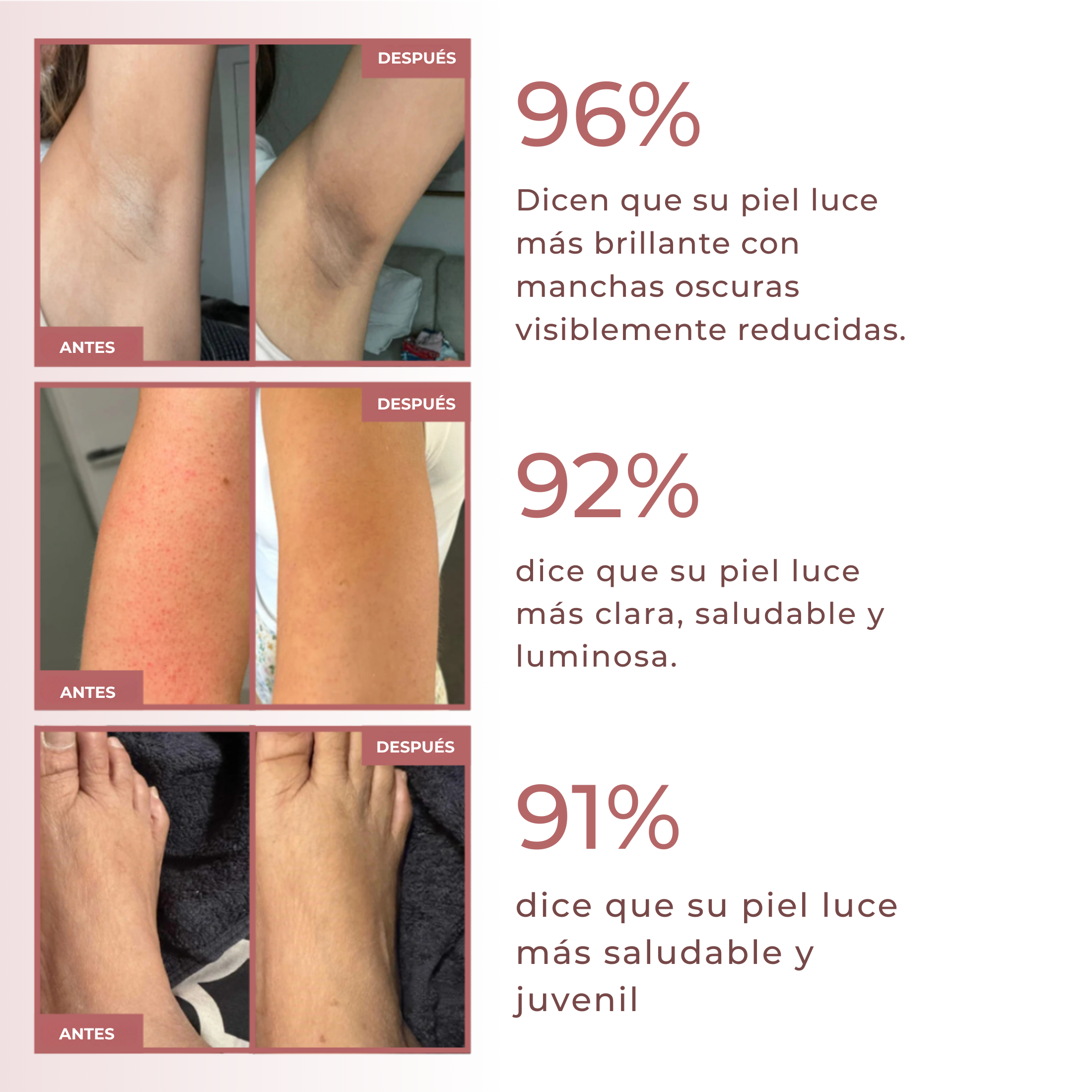 Spray esfoliante corpo - Acido Kojico + Curcuma miniatura 2
