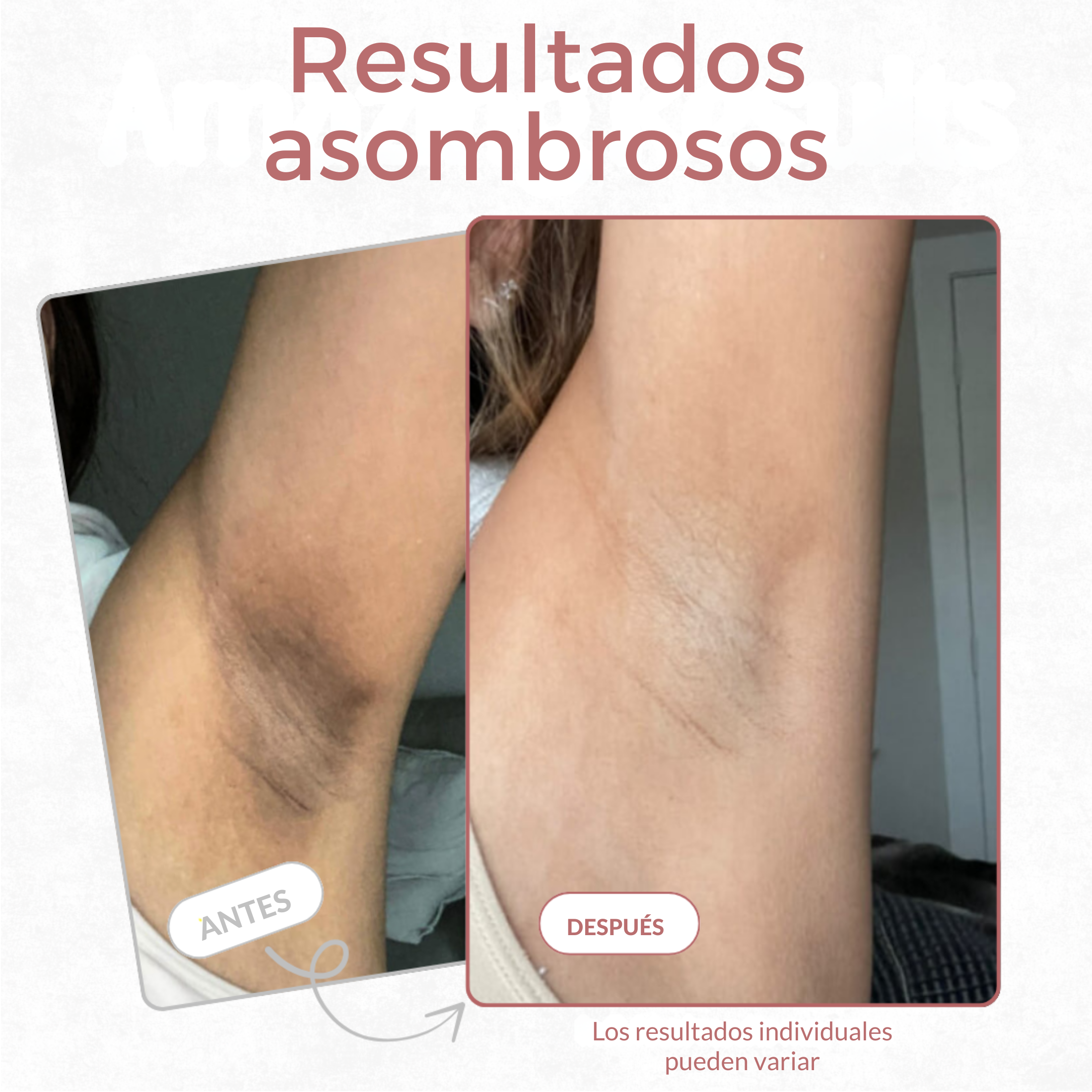 Spray esfoliante corpo - Acido Kojico + Curcuma miniatura 9